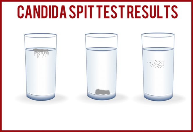 Da li imate kandidu? Test sa pljuvačkom....